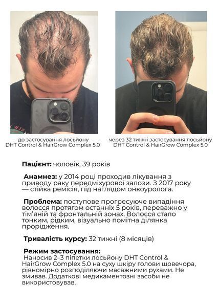Сироватка для відновлення росту волосся DHT Control & Hairgrow Complex 5.0 DHT-CONTROL фото